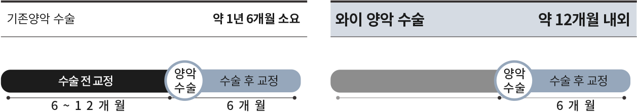 양악교정 방식