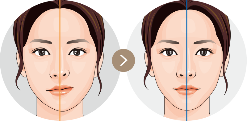 안면비대칭 이미지